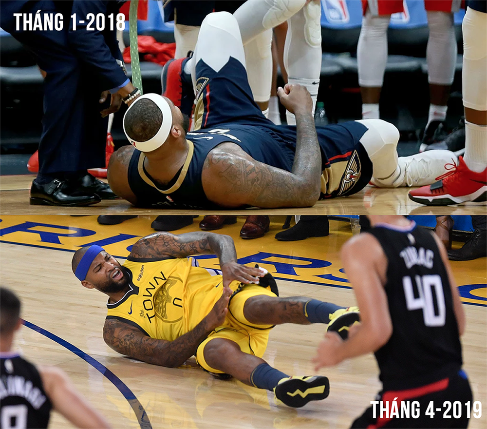 Hai năm hai chấn thương tệ hại: Câu chuyện buồn không hồi kết của DeMarcus Cousins Hai năm hai chấn thương tệ hại: Câu chuyện buồn không hồi kết của DeMarcus Cousins